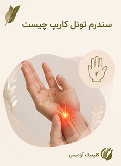 سندرم تونل کارپ چیست